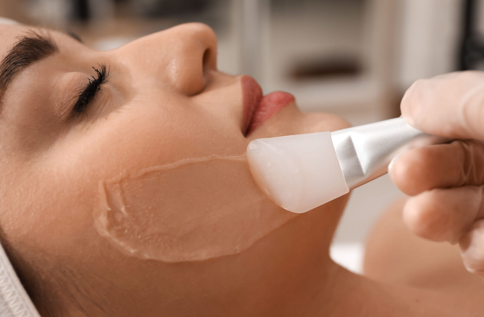 10 Benefits of a Chemical Peel | Scottsdale, AZ