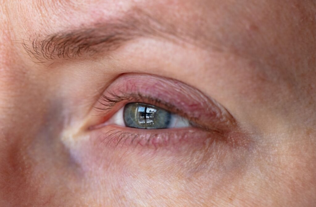 An intense close-up of a watery left eye.