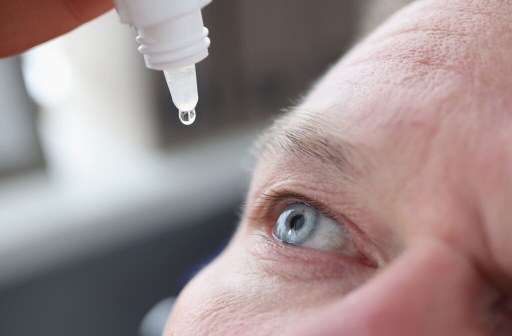 Close-up of a person applying eye drops to their eye with precision.