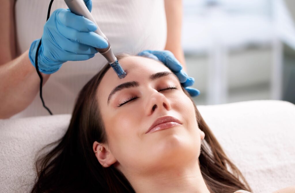 A person receiving a microneedling treatment on their forehead